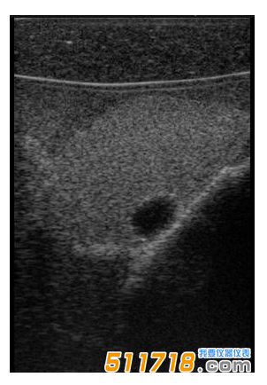 1534992907438311.png 美國CIRS 074甲狀腺超聲訓練模體1.png