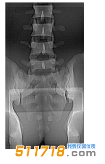 1535016002176928.png 美國CIRS 034腰椎穿刺訓(xùn)練模體1.png